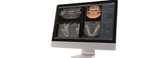 CT scanning