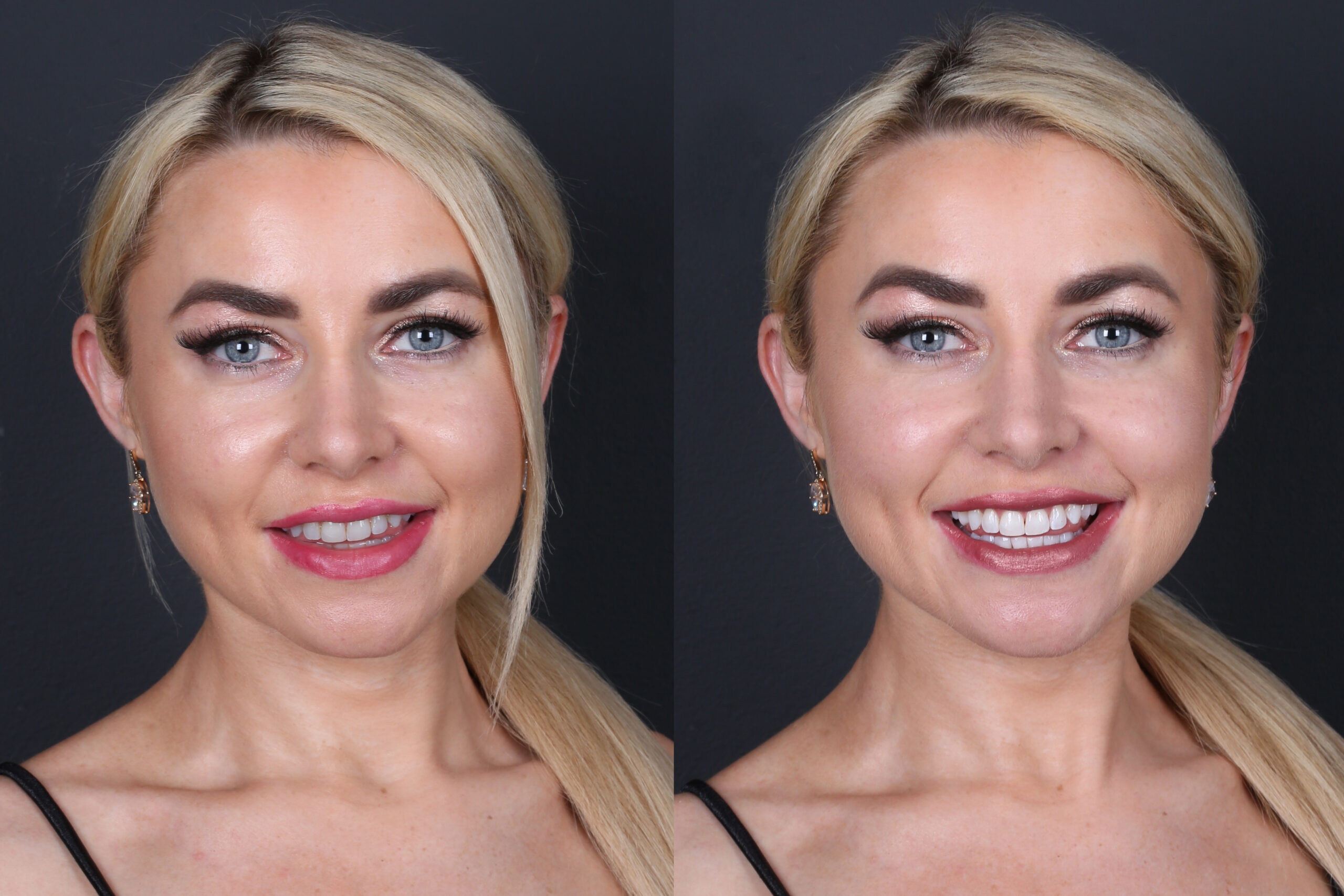 Smile Gallery Seapoint Clinic | Dental Clinic