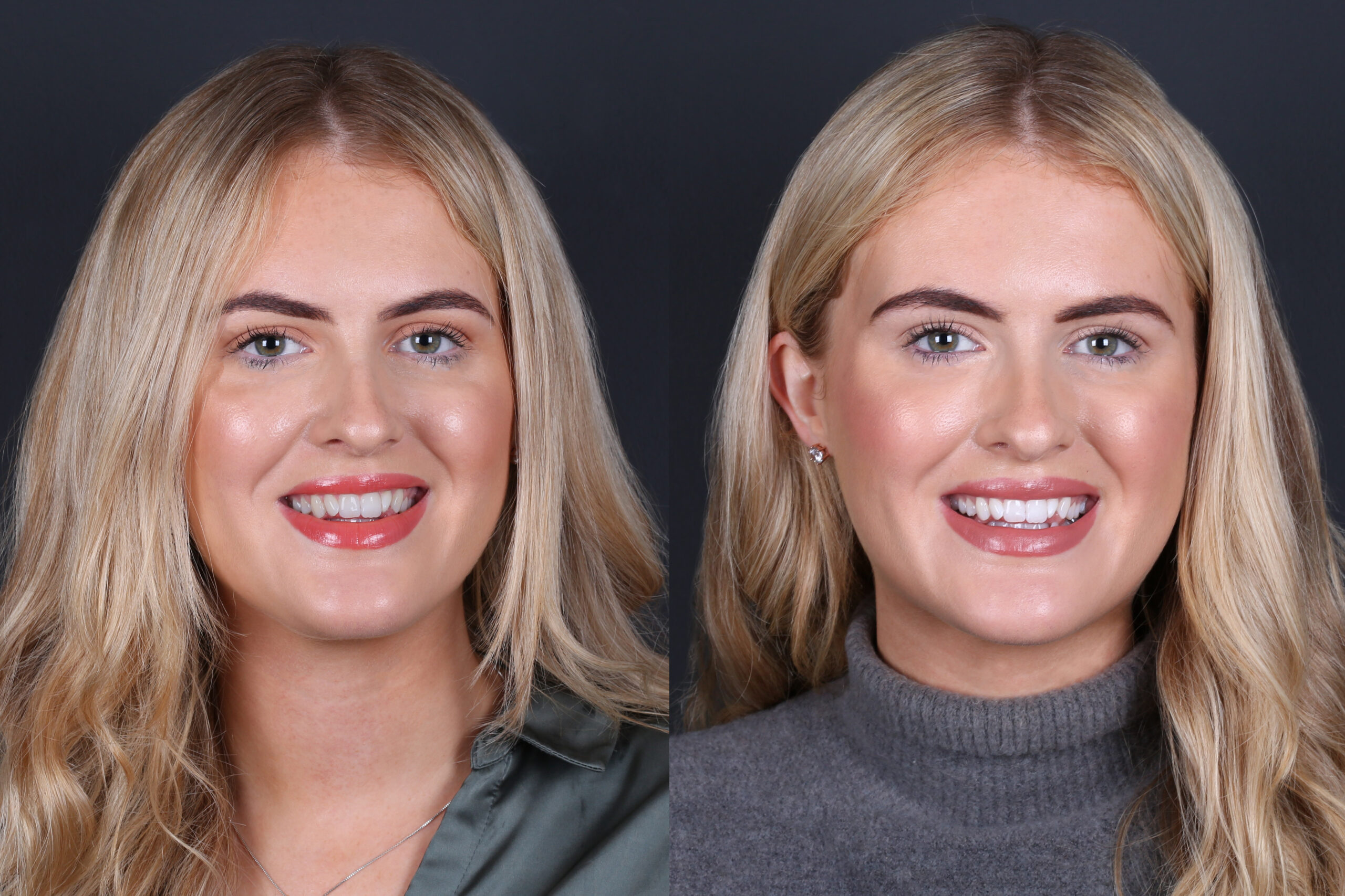 Smile Gallery Seapoint Clinic | Dental Clinic
