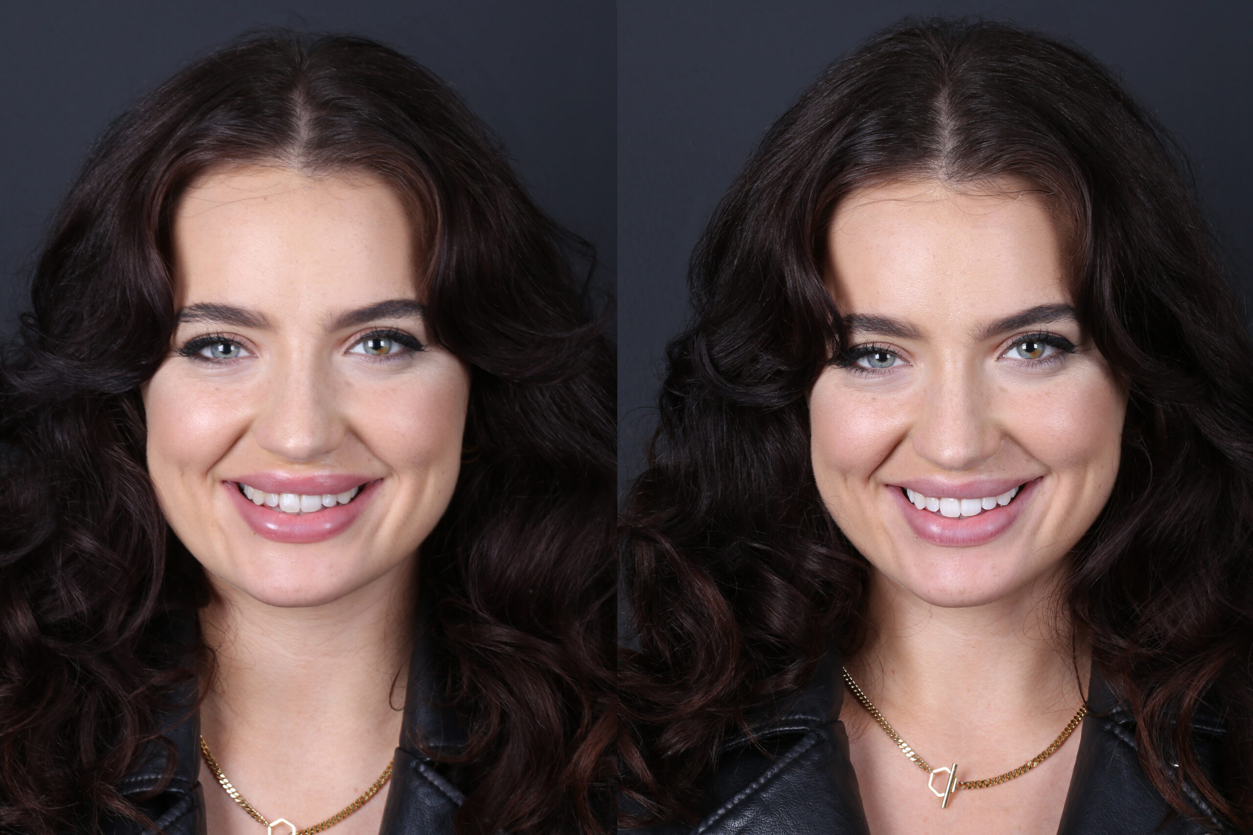 Smile Gallery Seapoint Clinic | Dental Clinic