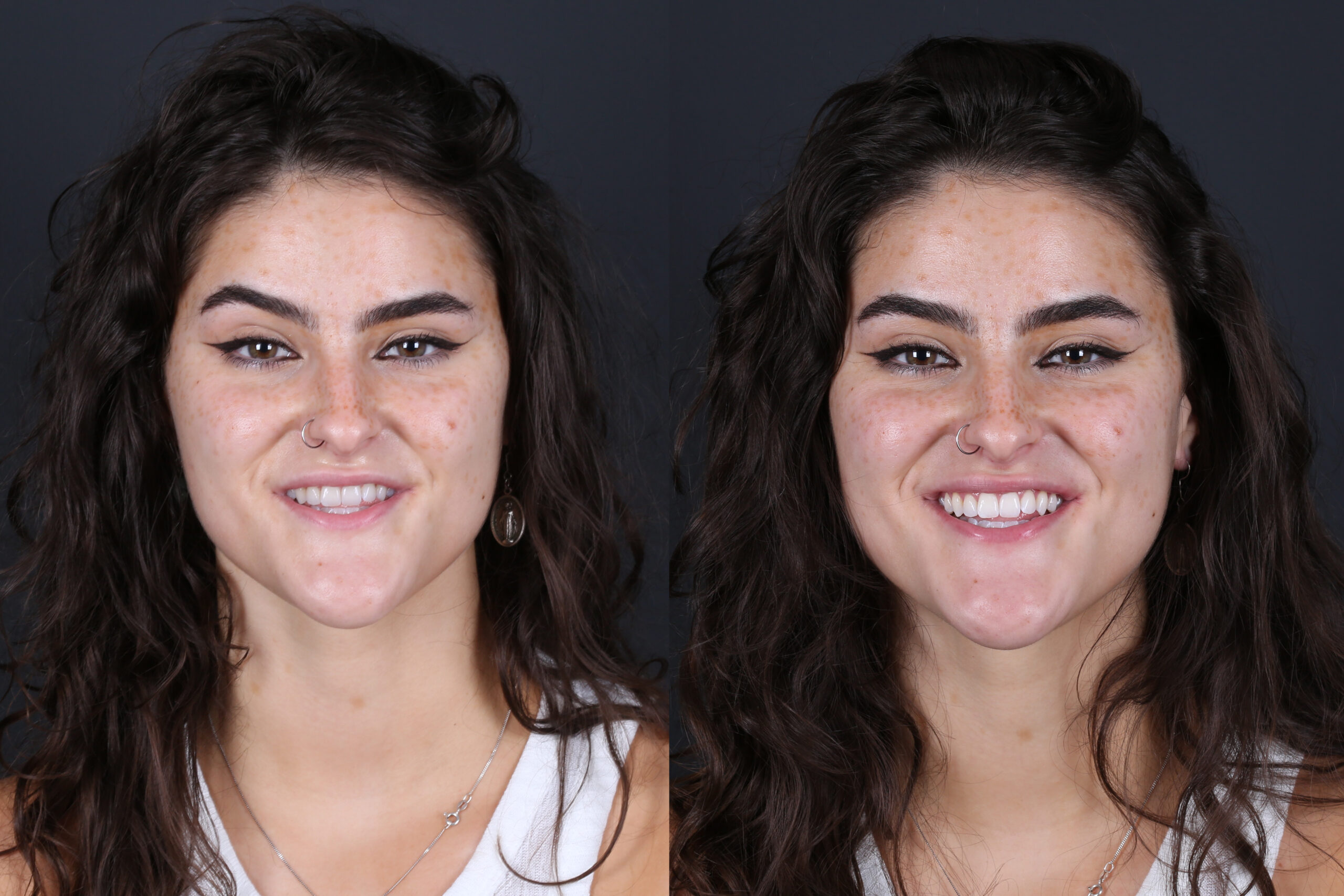 Smile Gallery Seapoint Clinic | Dental Clinic