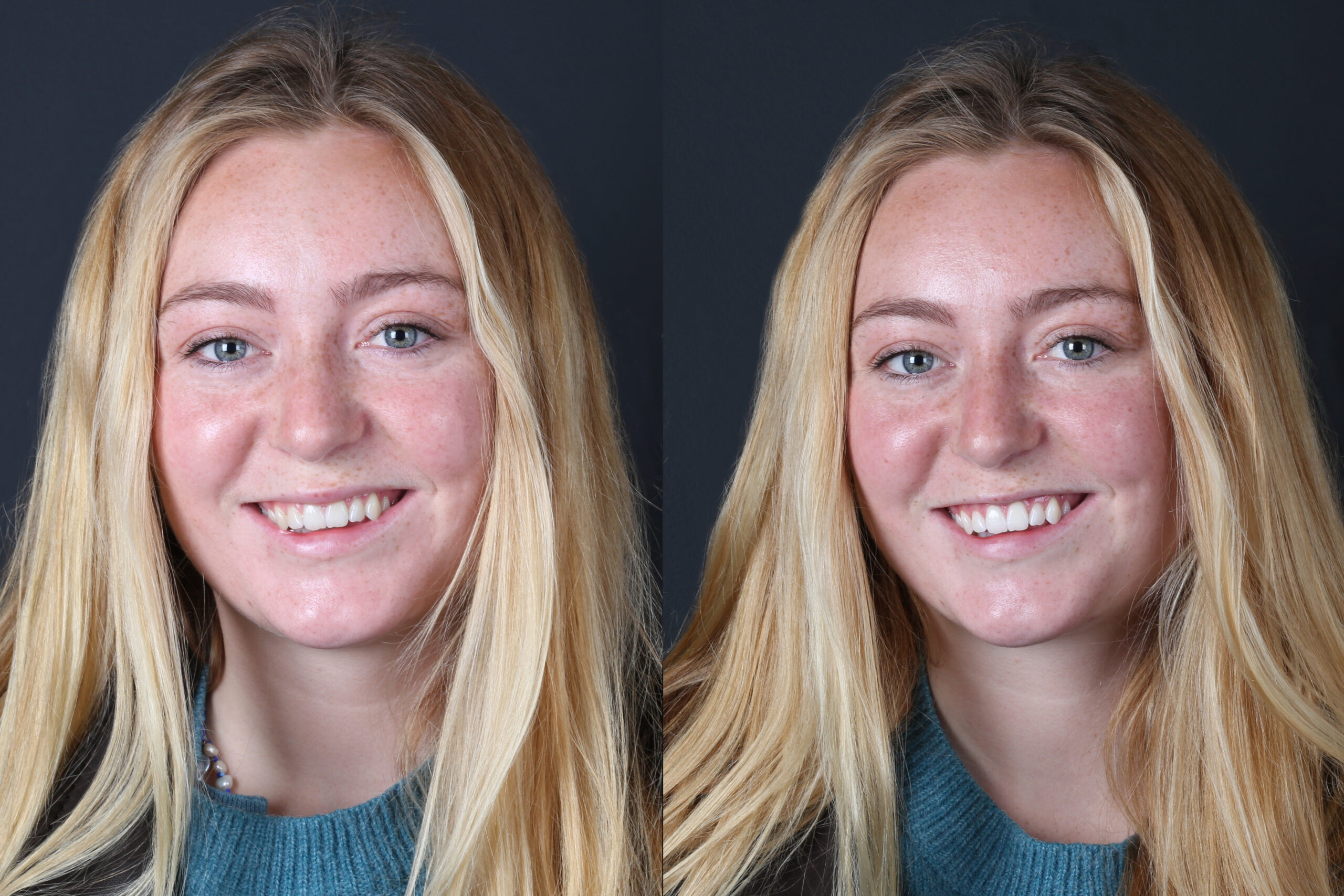 Smile Gallery Seapoint Clinic | Dental Clinic
