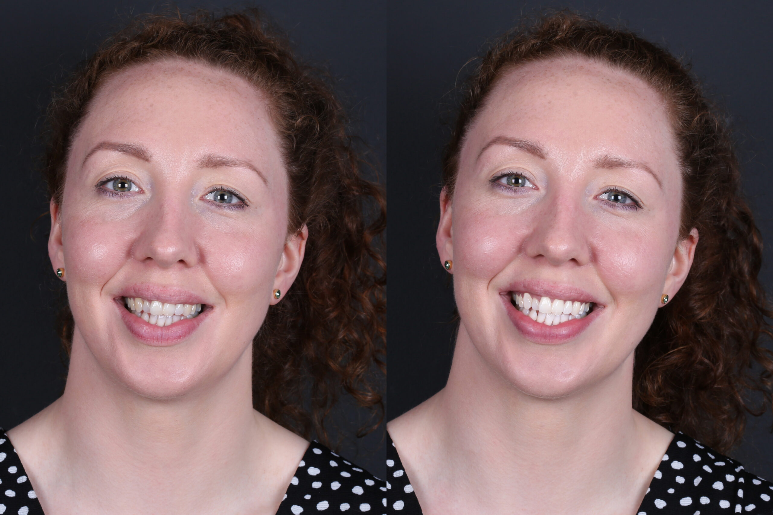 Smile Gallery Seapoint Clinic | Dental Clinic