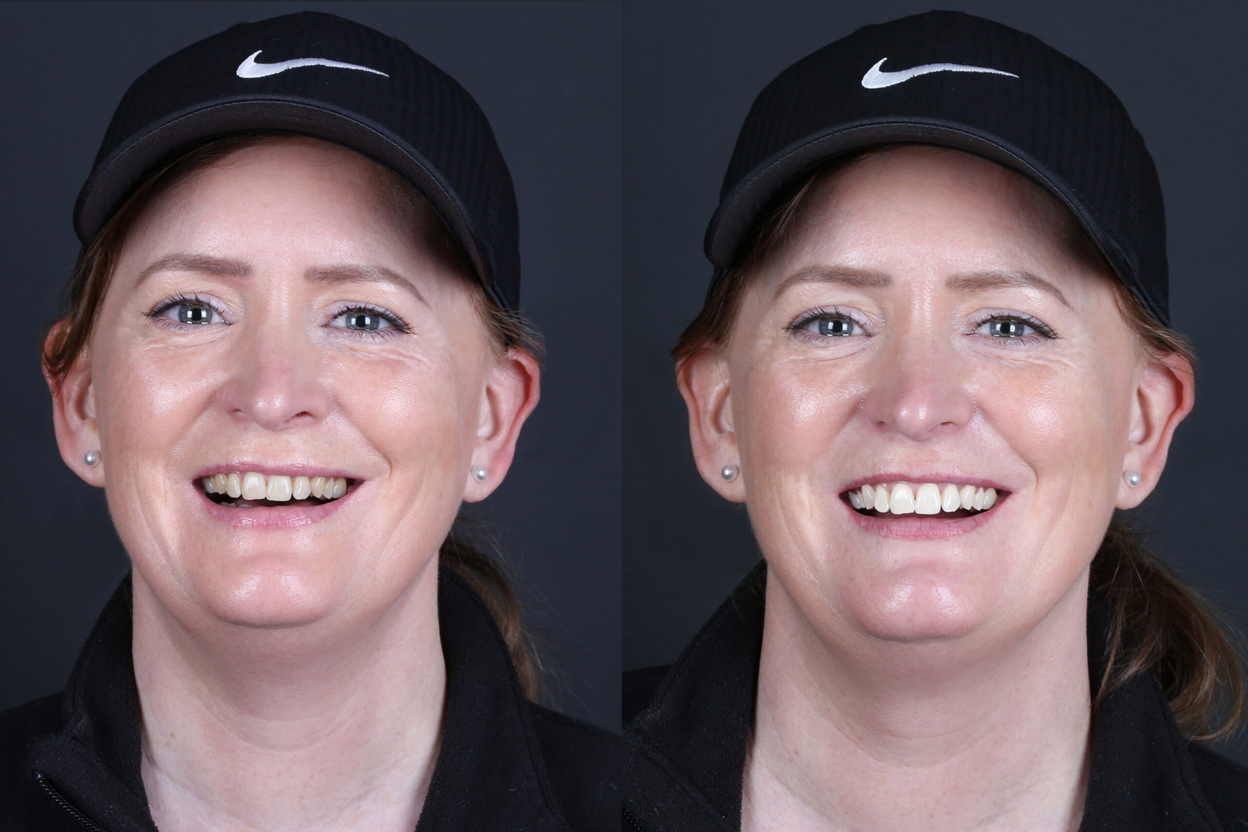 Smile Gallery Seapoint Clinic | Dental Clinic