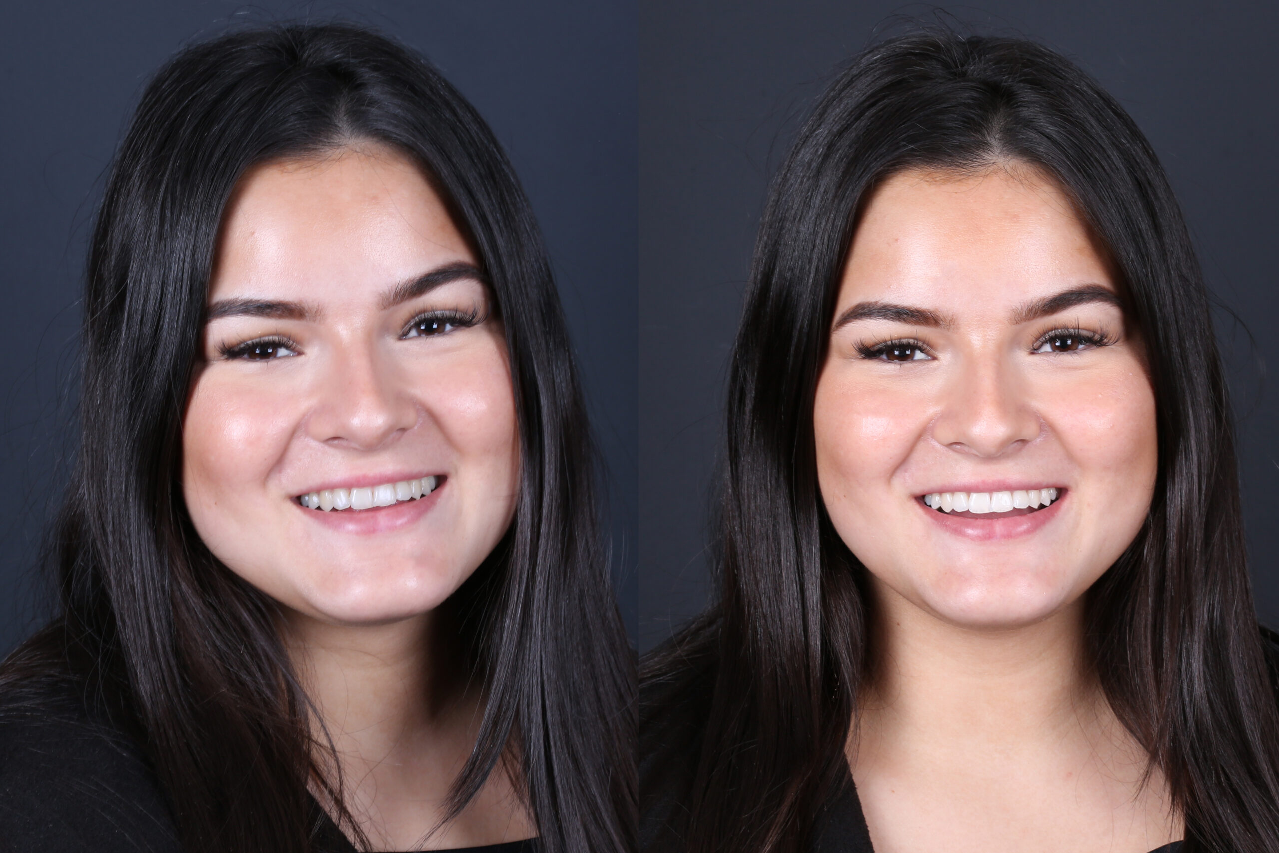 Smile Gallery Seapoint Clinic | Dental Clinic