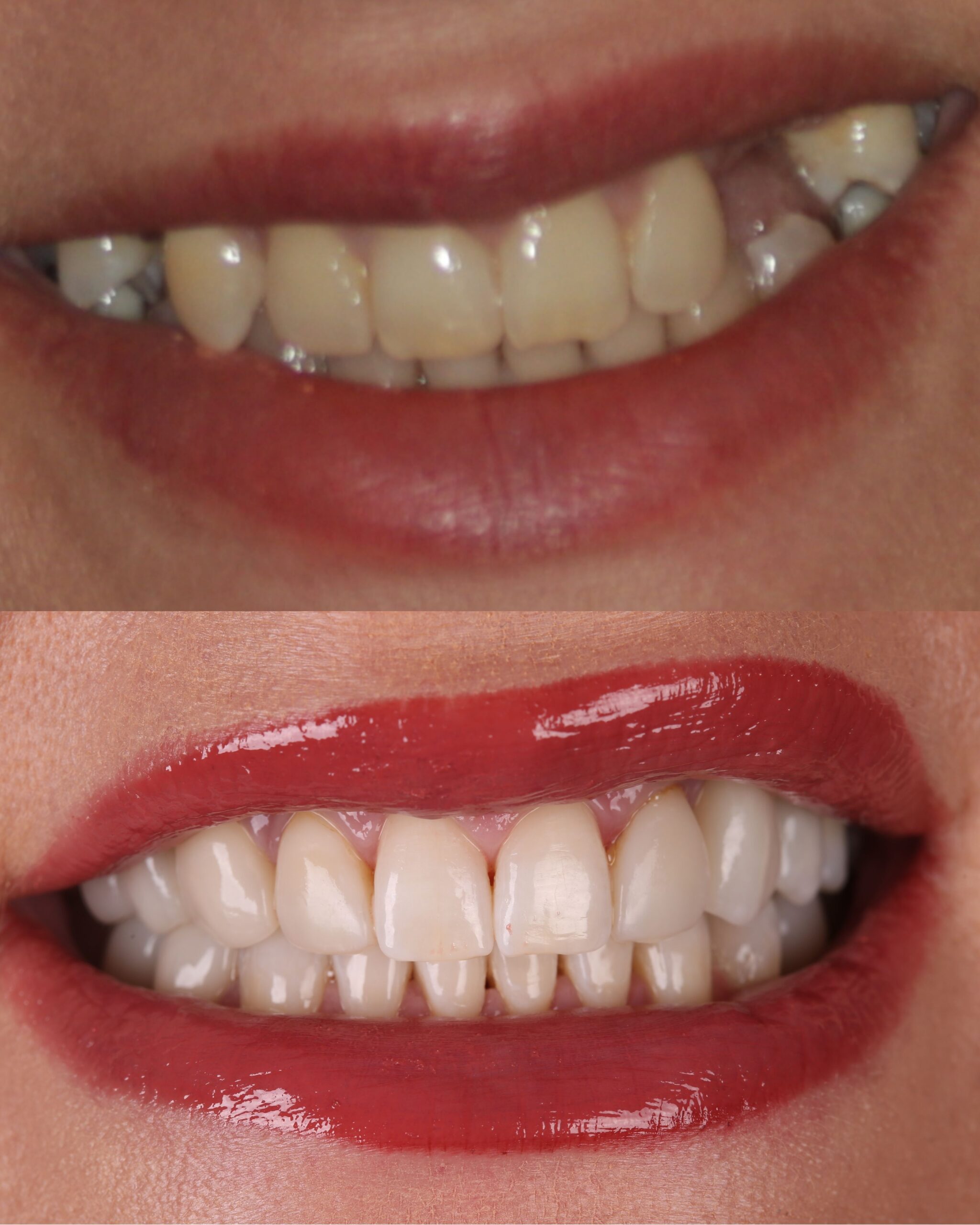Smile Gallery Seapoint Clinic | Dental Clinic